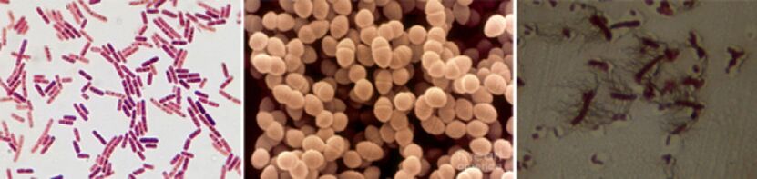 E. coli, entérocoque fécal et proteus sont les principaux agents étiologiques de la prostatite bactérienne chronique