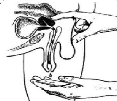 Massage de la prostate pour la sécrétion